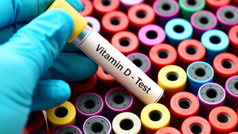 Exame vitamina D: como funciona e por que é importante